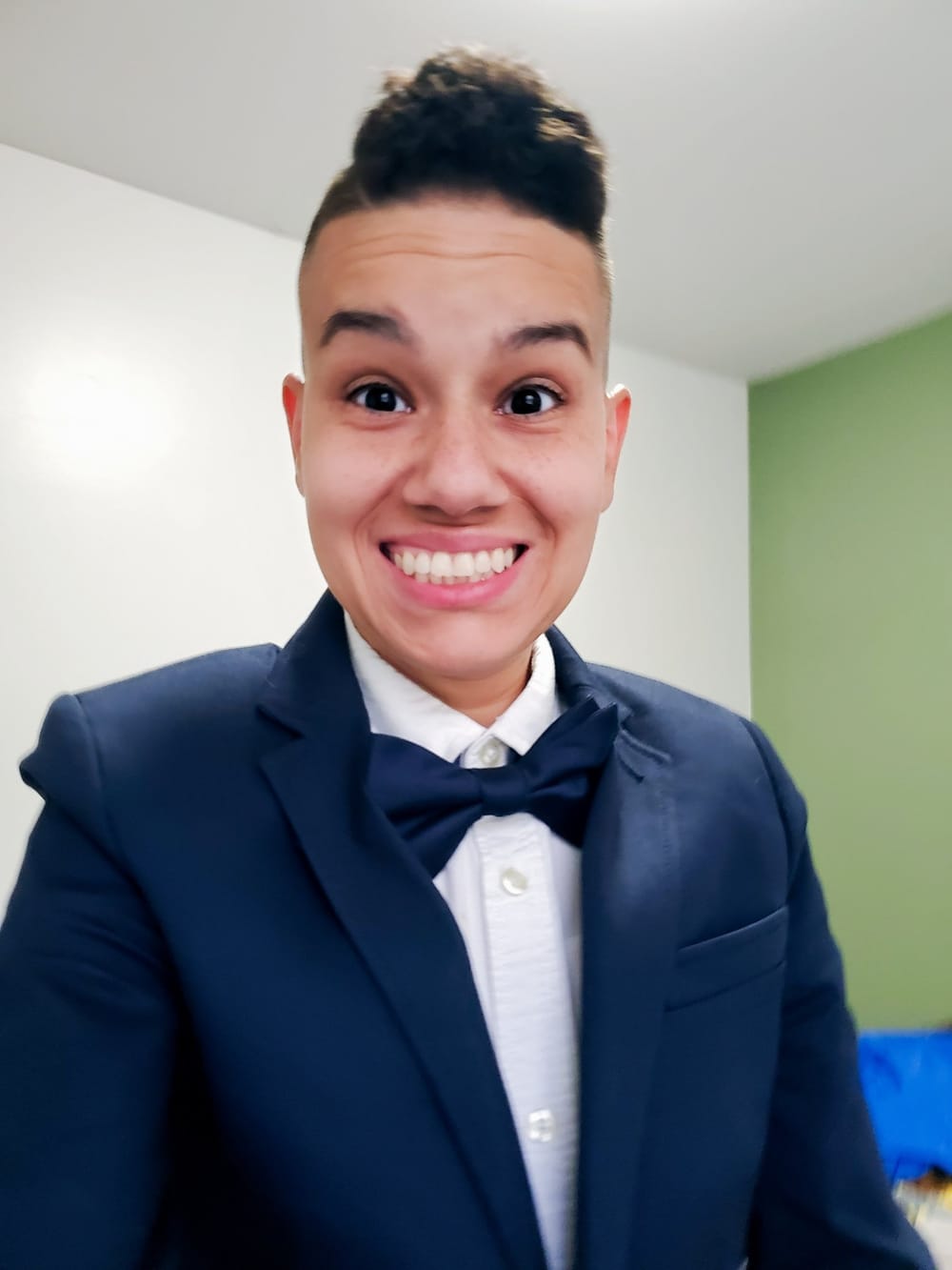 Navigating Breast Cancer Beyond the Binary post image